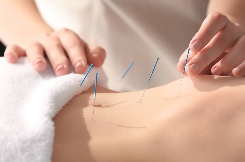 ACUPUNCTURE: The Bellingen Community Acupuncture and Shiatsu Clinic serves the Bellingen community by offering quality acupuncture and shiatsu treatments.